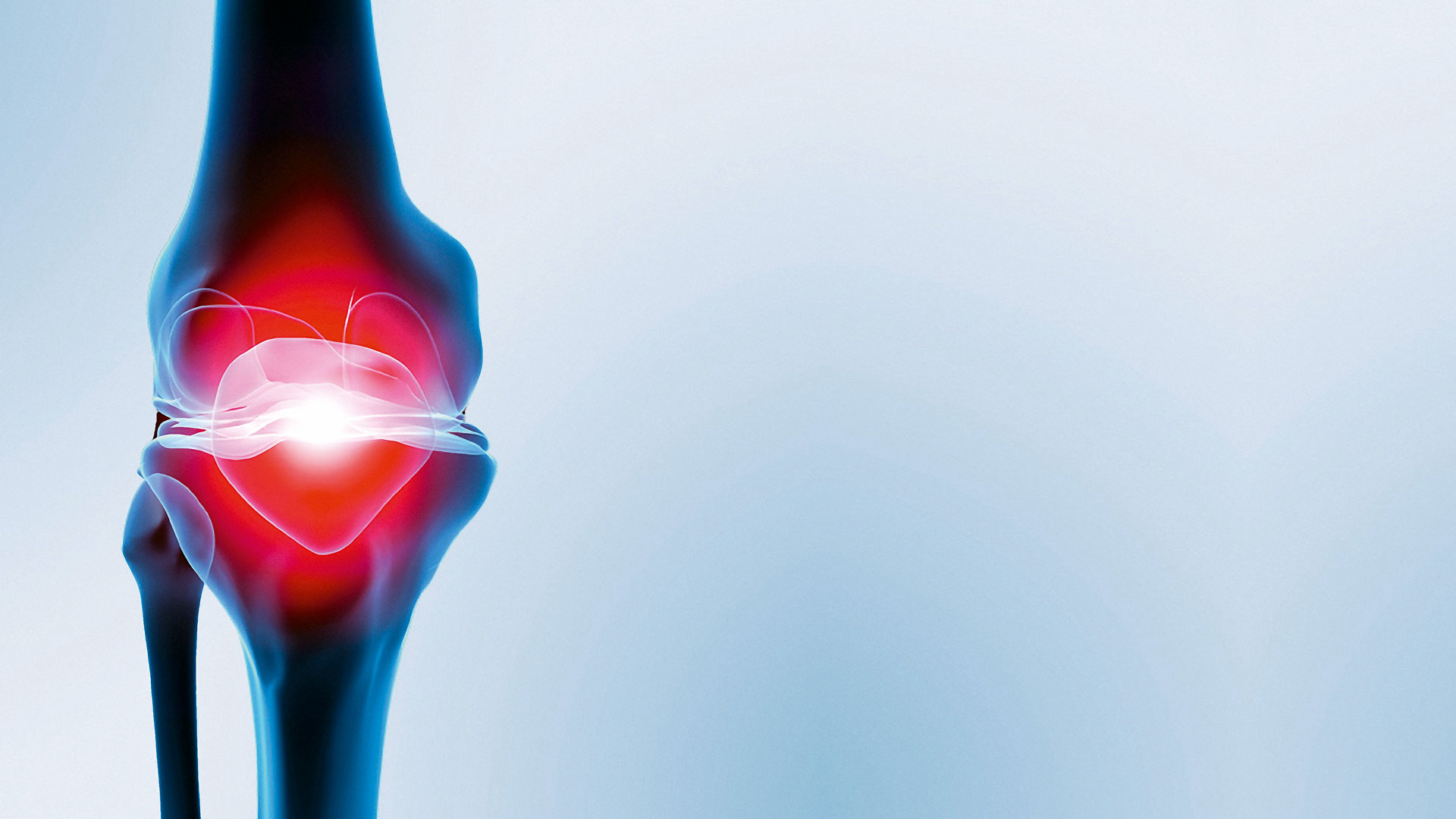 periartrita scapulohumerala tratament artroza raportului genunchiului